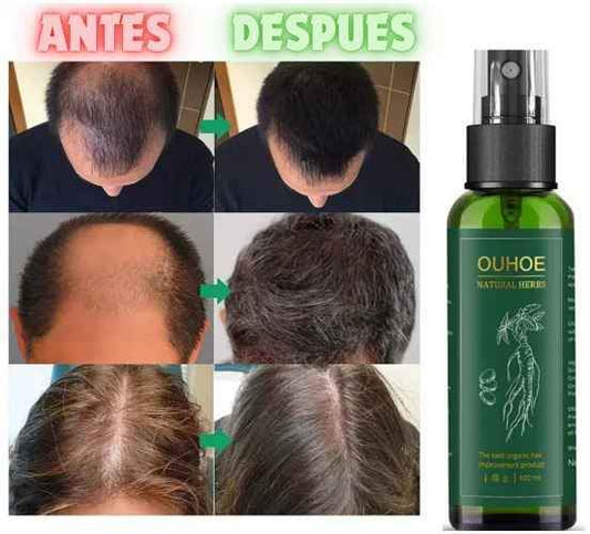 Tónico Capilar Anticaída – Frena la Caída, Estimula el Crecimiento y Recupera tu Cabello Fuerte